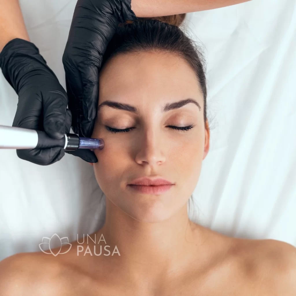 Tratamiento facial microneedling con Dermapen para rejuvenecer y renovar la piel